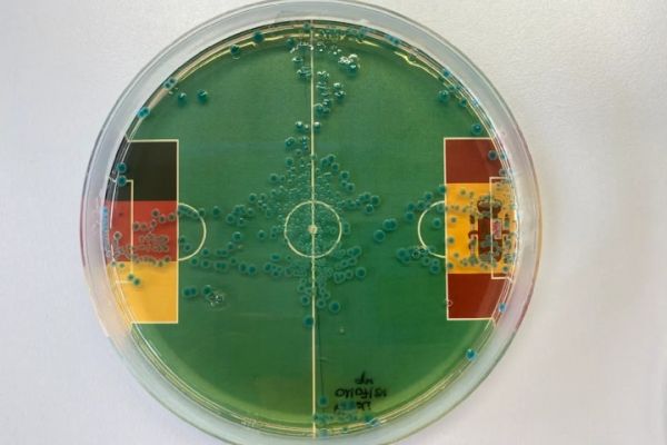  پیشگویی باکتری‌ها از نتیجه بازی آلمان و اسپانیا چیست