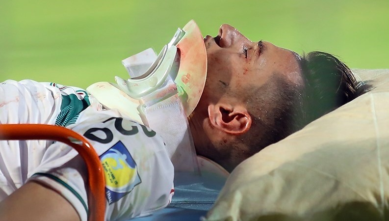 حبیب‌زاده تحت عمل جراحی قرار گرفت/ فک بازیکن ذوب‌آهن از چهار ناحیه شکسته است