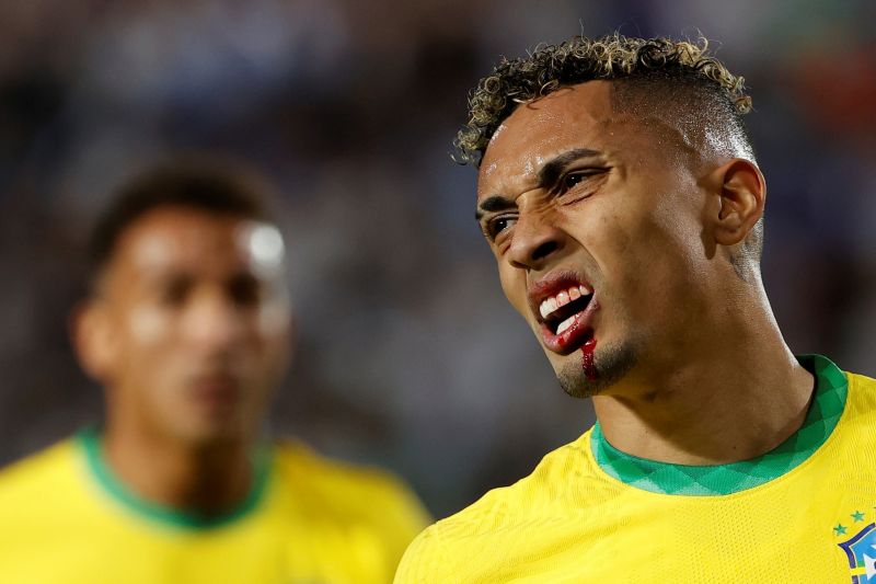 عکس؛ آرنج خشن اوتامندی به بازیکن برزیل که دهان او را خونی کرد!